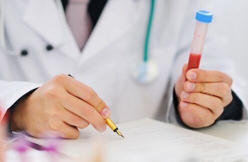 testovi za prostatitis za propisivanje lijekova